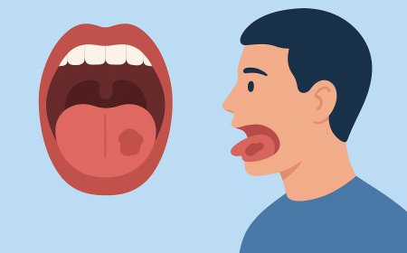 الوقاية من سرطان الفم: دليلك الكامل لحماية نفسك